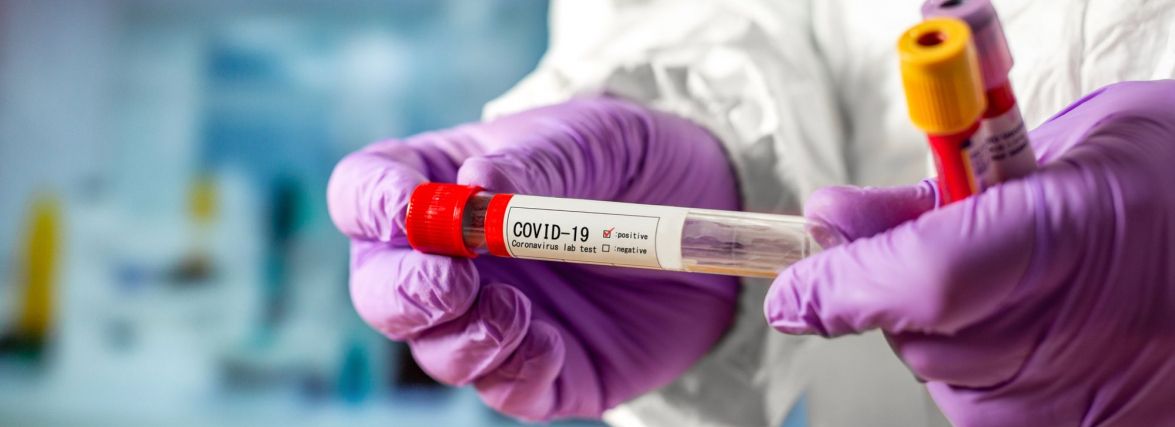 За последние 24 часа выявлен 61 новый случай коронавирусной инфекции, 1 человек скончался.