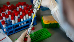 За минулу добу у 349 осіб на Закарпатті  підтверджено коронавірус методом ПЛР. 