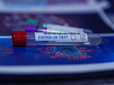 За добу виявлено 47 нових випадків коронавірусної інфекції. Про це інформують у прес-службі Ужгородської міської ради.