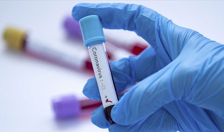 В Україні зафіксовано 113 випадків зараження коронавірусом, повідомляє ДСНС. За останню добу виявили 29 хворих.
