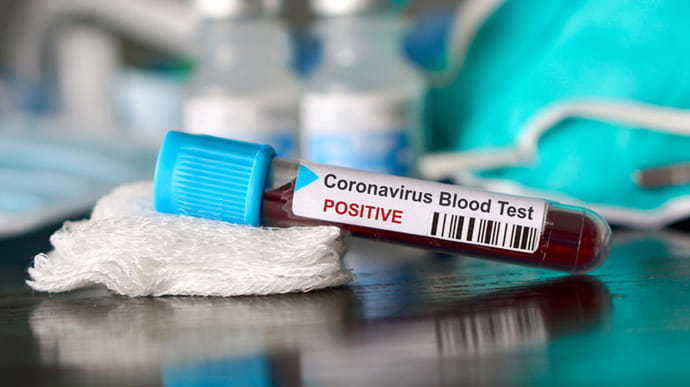 На Закарпатті 20 нових випадків коронавірусу за добу, двоє людей померли.