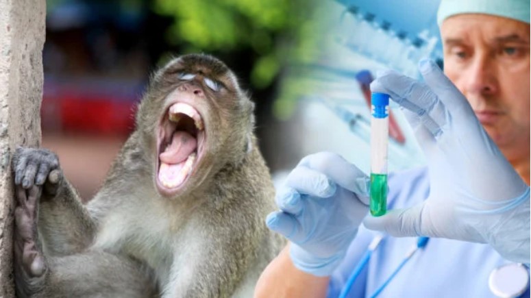 У четвер, 15 вересня, перший випадок мавпячої віспи лабораторно підтвердили в Україні.

