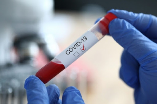 Про кількість нових хворих коронавірусом за добу в Ужгороді повідомляють у прес-службі Ужгородської міської ради.
